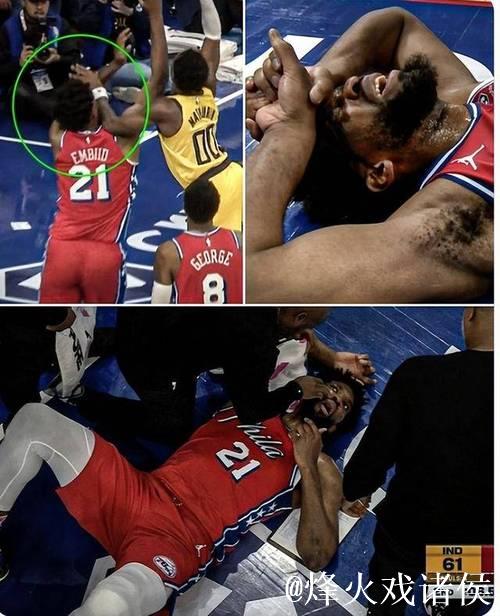 恩比德鼻子骨折76人不敌步行者 骑士力克奇才
